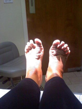 Illustration for article titled Wendy Williams Has Some Messed-Up Feet